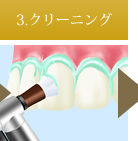 3.クリーニング